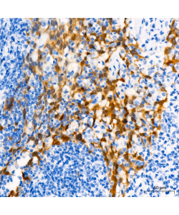 CDKN2A/p16INK4a Mouse Monoclonal Antibody