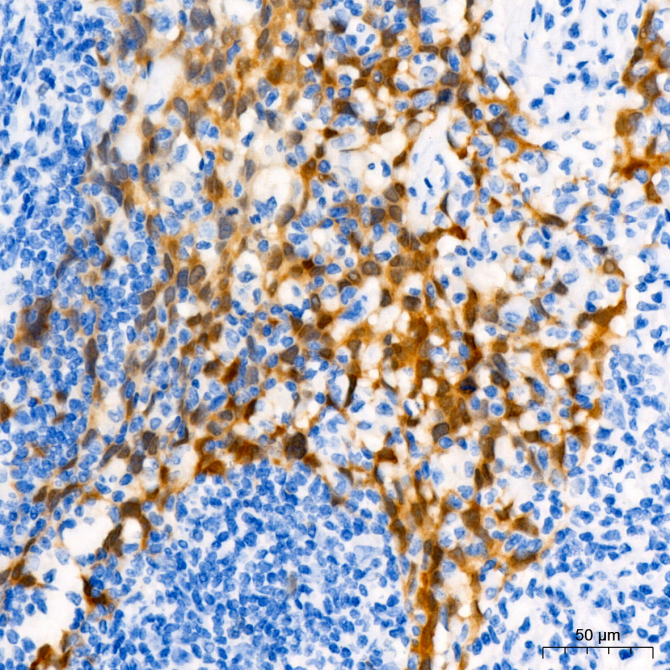 CDKN2A/p16INK4a Mouse Monoclonal Antibody