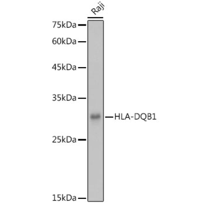 HLA-DQB1 Rabbit Polyclonal Antibody