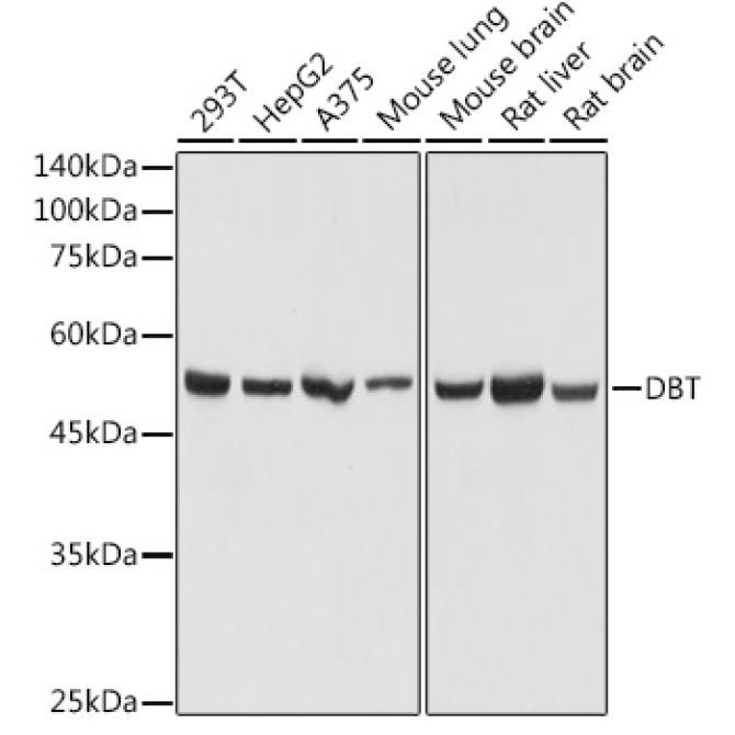 DBT Rabbit Polyclonal Antibody
