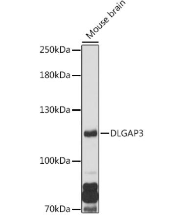 DLGAP3 Rabbit Polyclonal Antibody