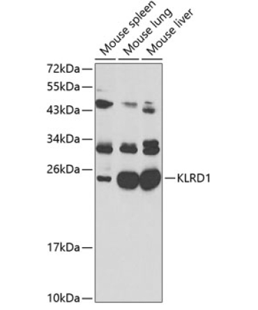 KLRD1 Rabbit Polyclonal Antibody
