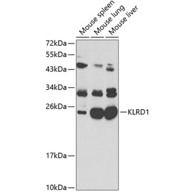 KLRD1 Rabbit Polyclonal Antibody