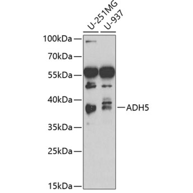 ADH5/GSNOR Rabbit Polyclonal Antibody