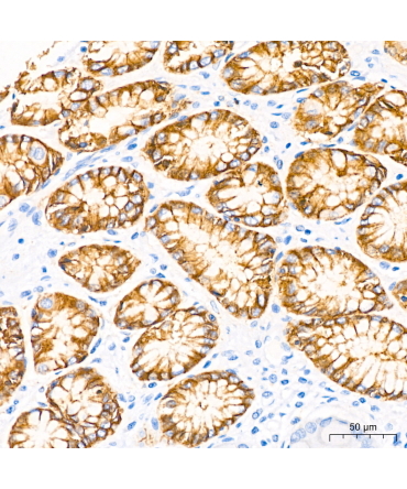 Claudin18.2 Rabbit Monoclonal Antibody