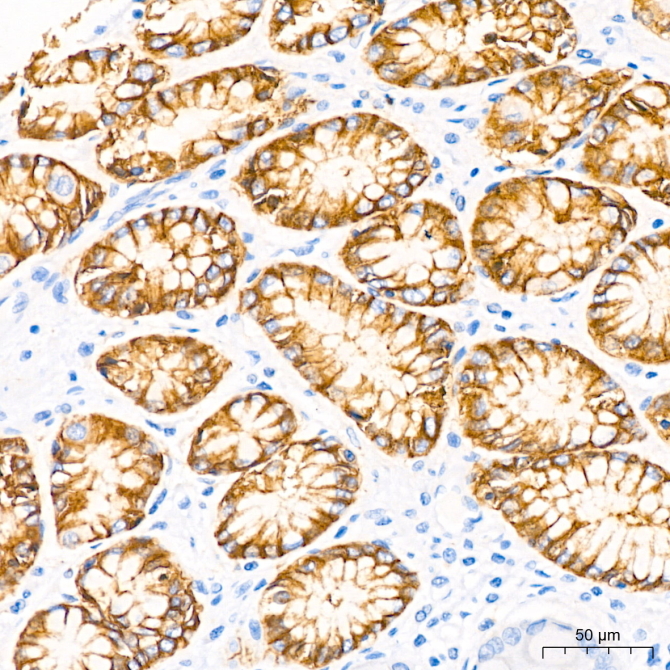 Claudin18.2 Rabbit Monoclonal Antibody
