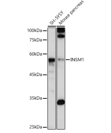 INSM1 Rabbit Polyclonal Antibody