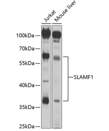 CD150/SLAM Rabbit Polyclonal Antibody