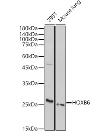 HOXB6 Rabbit Polyclonal Antibody