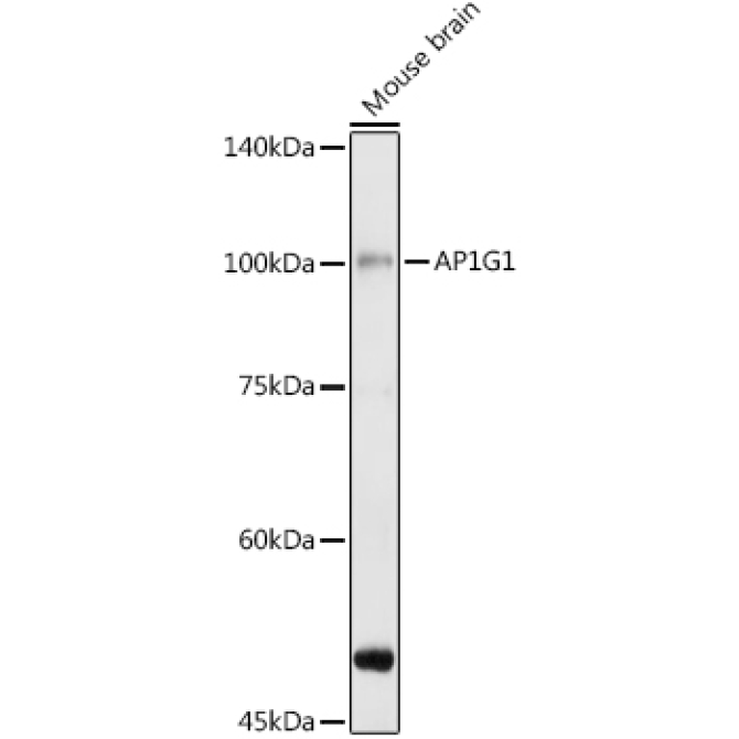 AP1G1 Rabbit Polyclonal Antibody
