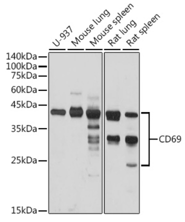 CD69 Rabbit Polyclonal Antibody