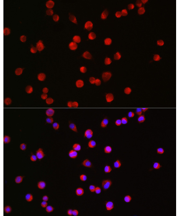 BSN Rabbit Polyclonal Antibody