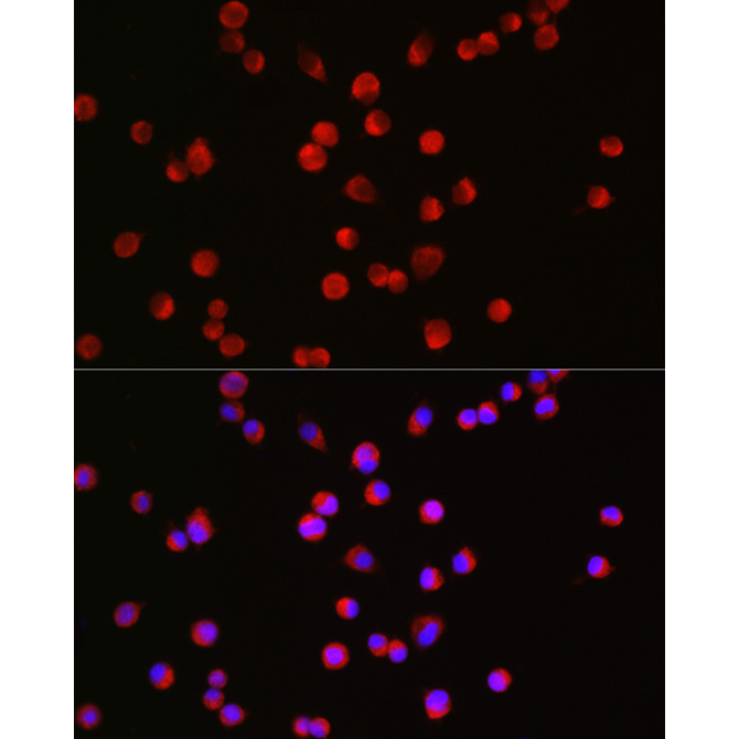 BSN Rabbit Polyclonal Antibody