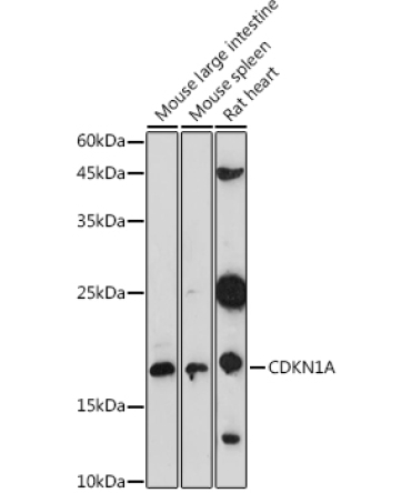 CDKN1A Rabbit Polyclonal Antibody
