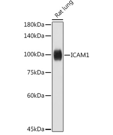 ICAM1 Rabbit Polyclonal Antibody