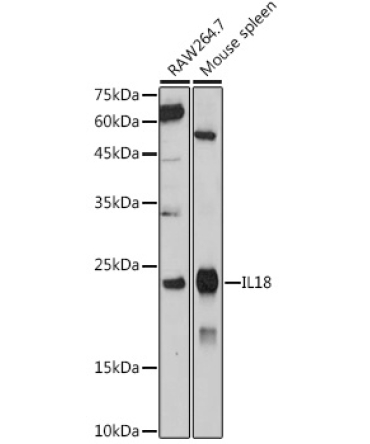 IL18 Rabbit Polyclonal Antibody