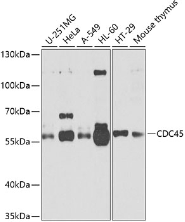 CDC45 Rabbit Polyclonal Antibody