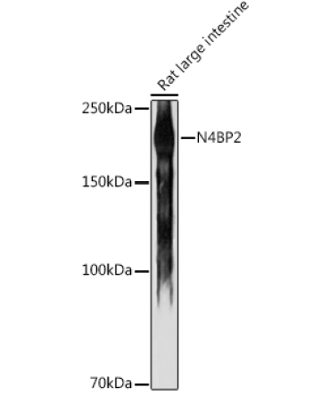 N4BP2 Rabbit Polyclonal Antibody