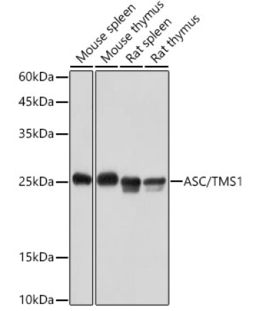 ASC/TMS1 Rabbit Polyclonal Antibody