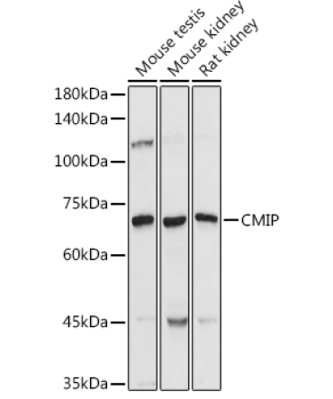 CMIP Rabbit Polyclonal Antibody