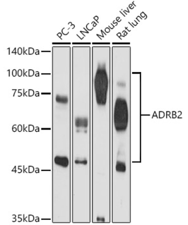 ADRB2 Rabbit Polyclonal Antibody