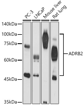ADRB2 Rabbit Polyclonal Antibody