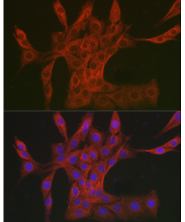 DAB2IP Rabbit Polyclonal Antibody