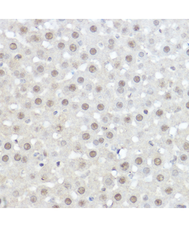AHNAK Rabbit Polyclonal Antibody