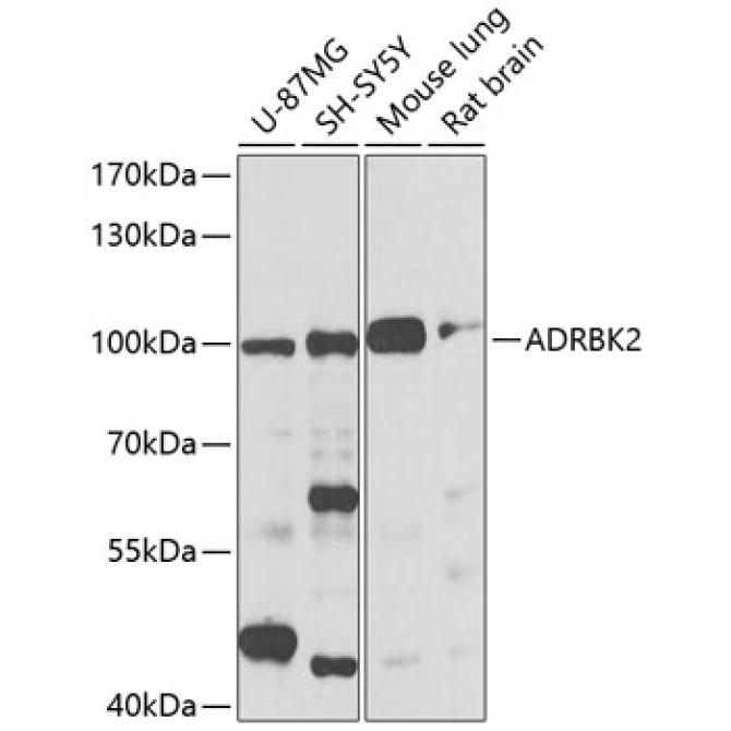 ADRBK2 Rabbit Polyclonal Antibody