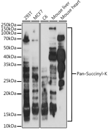 Pan-Succinyl-K Rabbit Polyclonal Antibody