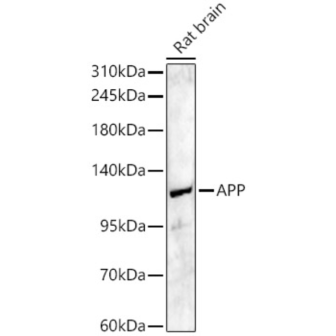 APP Rabbit Polyclonal Antibody