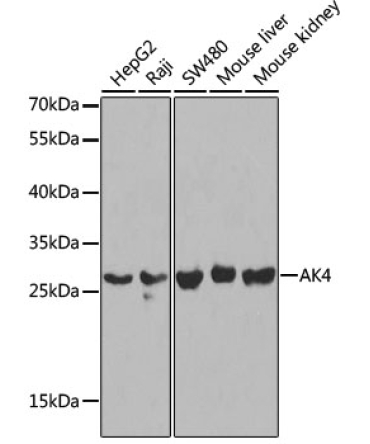 AK4 Rabbit Polyclonal Antibody