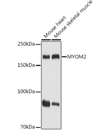MYOM2 Rabbit Polyclonal Antibody