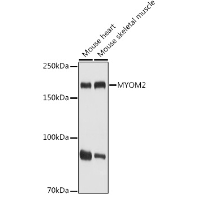 MYOM2 Rabbit Polyclonal Antibody