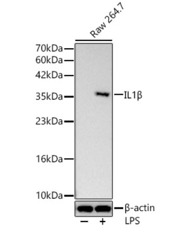 IL1Beta Rabbit Polyclonal Antibody