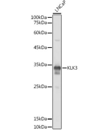 KLK3 Rabbit Polyclonal Antibody