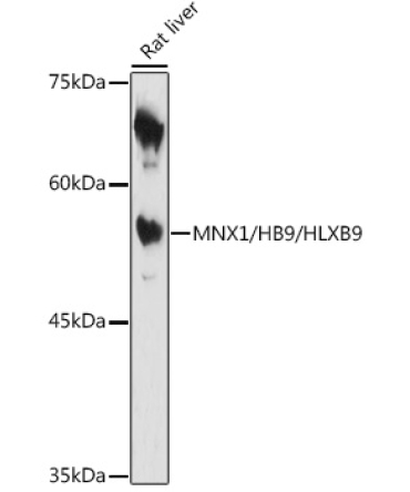 MNX1/HB9/HLXB9 Rabbit Polyclonal Antibody