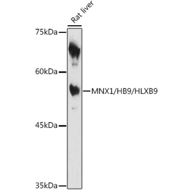 MNX1/HB9/HLXB9 Rabbit Polyclonal Antibody