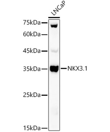 NKX3.1 Rabbit Polyclonal Antibody
