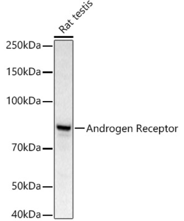Androgen Receptor Rabbit Polyclonal Antibody