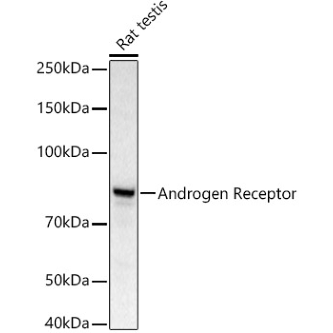 Androgen Receptor Rabbit Polyclonal Antibody