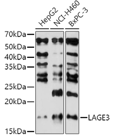 LAGE3 Rabbit Polyclonal Antibody