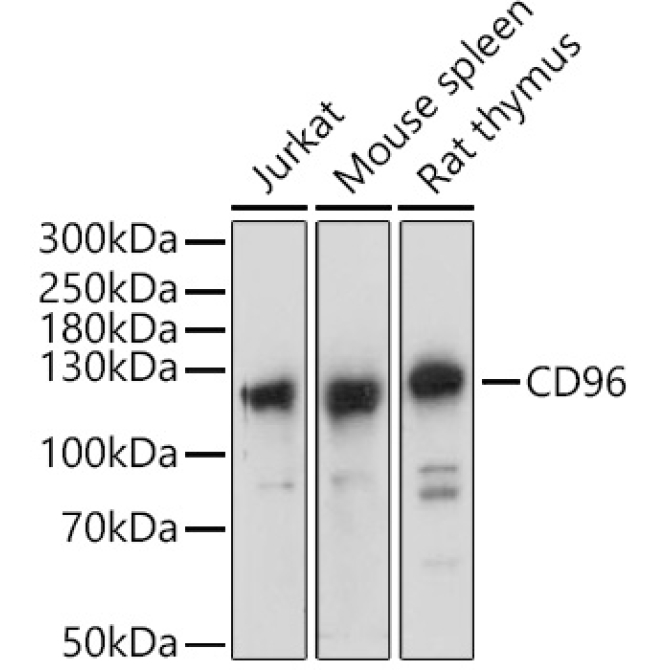 CD96 Rabbit Polyclonal Antibody