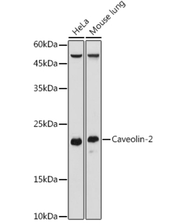 Caveolin-2 Rabbit Polyclonal Antibody