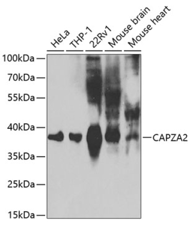 CAPZA2 Rabbit Polyclonal Antibody