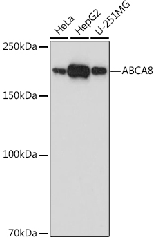 ABCA8 Rabbit Polyclonal Antibody
