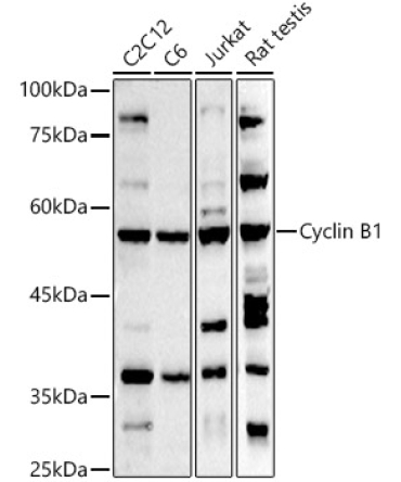 Cyclin B1 Rabbit Polyclonal Antibody