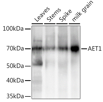 AET1 Rabbit Polyclonal Antibody