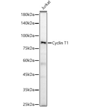 Cyclin T1 Rabbit Polyclonal Antibody
