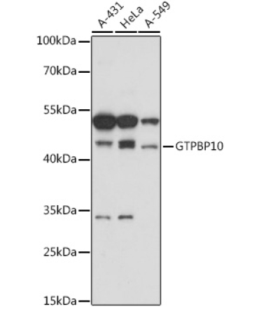 GTPBP10 Rabbit Polyclonal Antibody
